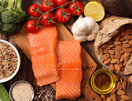Options variées d’aliments sains.